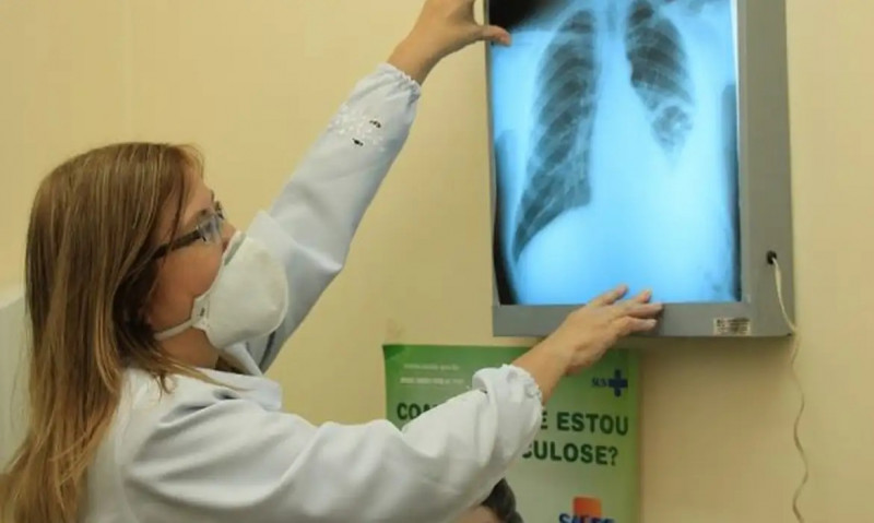 Tratamento de saúde contra a tuberculose - (Eduardo Gomes/FIOCRUZ)