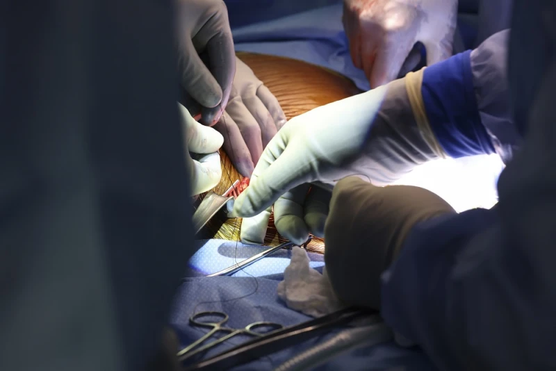Médico brasileiro realiza 1º transplante de rim de porco em humano nos EUA