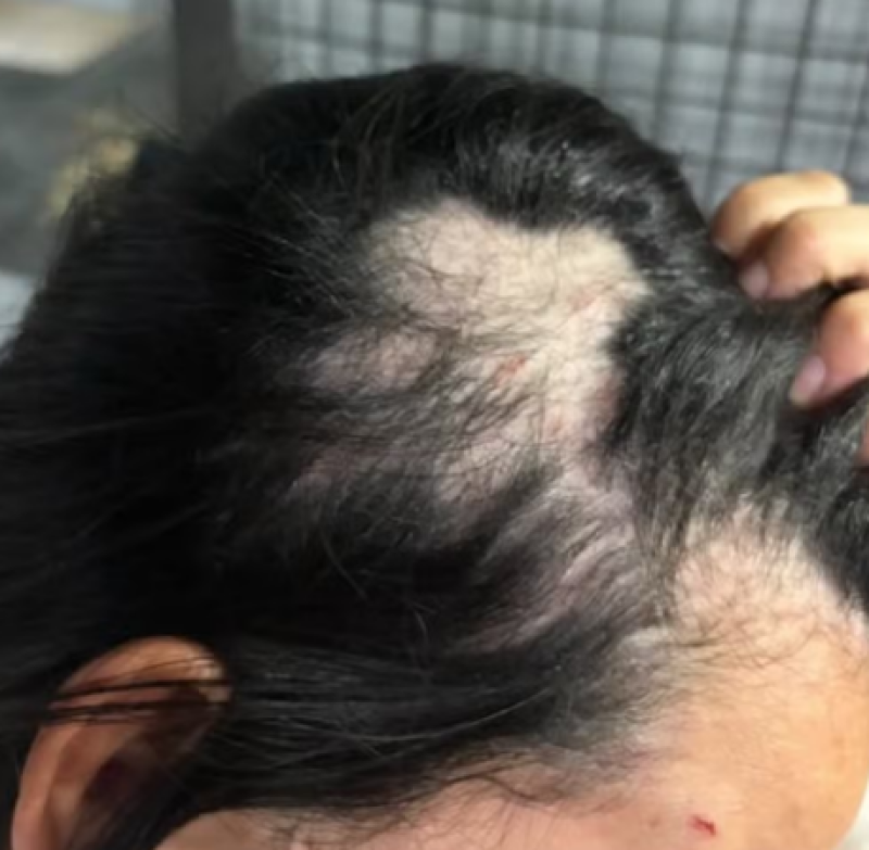'Nota dó': servidoras são exoneradas após agredirem mulher durante karaokê em academia