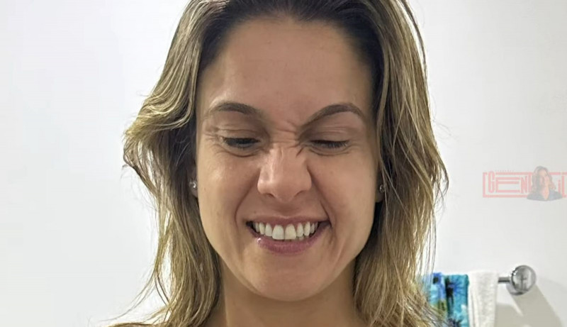 Fernanda relatou sintomas como dormência nos lábios e dificuldade em movimentar metade do rosto - (Reprodução/Youtube)