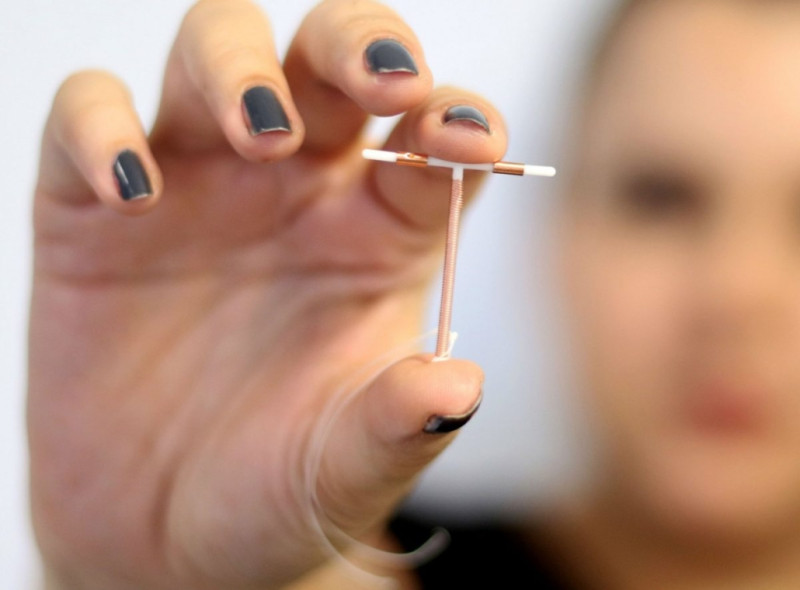 Entenda o que é o DIU e quais são as vantagens do método contraceptivo