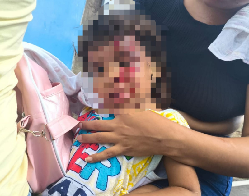 Criança é atingida por tijolo durante briga entre suspeito e o pai dela em Teresina