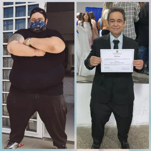 Vereador de Parnaíba, Brunão, morre aos 40 anos após complicações de cirurgia bariátrica - (Reprodução)