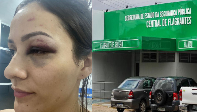 Vítima denunciou caso à polícia nesta segunda-feira (16)  - (Reprodução/Instagram)